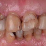 Equipos de última generación para cirugía oral mínimamente invasiva