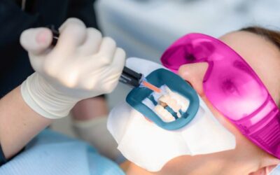 equiposparablanqueamientodentaltiposycuidad