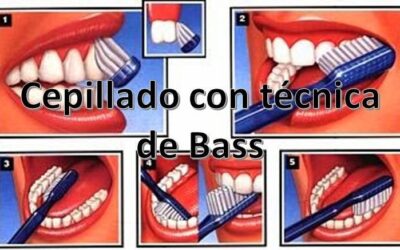 porquelcepilladodebeduraralmenosdosminu