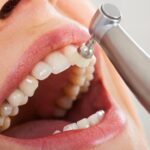 ¿Qué esperar de una limpieza dental profunda?