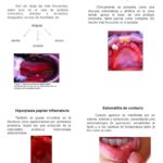 Cómo evitar lesiones bucales durante actividades físicas
