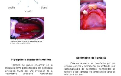 cmoevitarlesionesbucalesduranteactividadesf