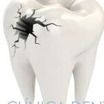 Experiencia con extracción dental sin complicaciones