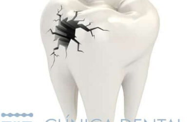 experienciaconextraccindentalsincomplicacion