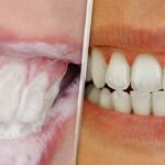 Técnicas para mantener los dientes blancos naturalmente