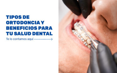 cmofuncionalaortodonciatradicionalysusbene