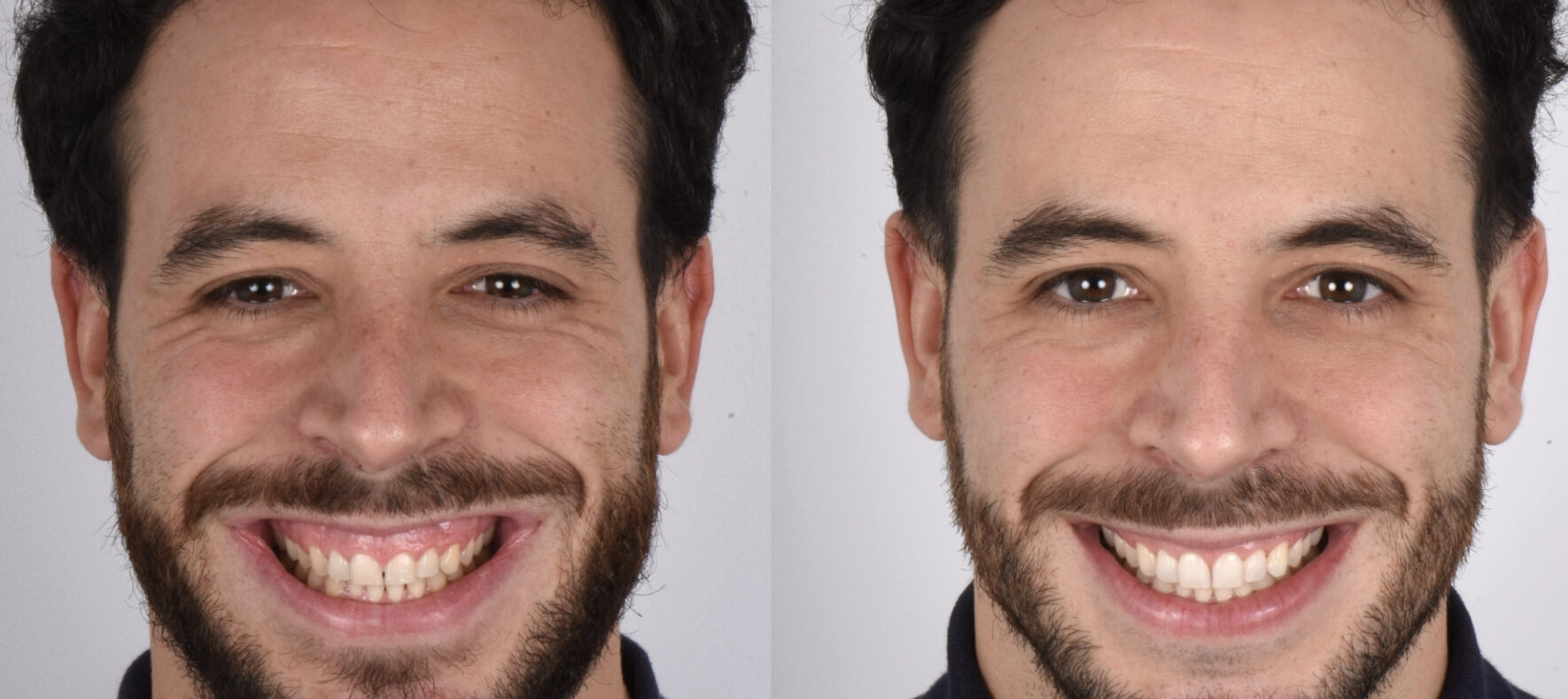 Clínica dental Chamberí turrión